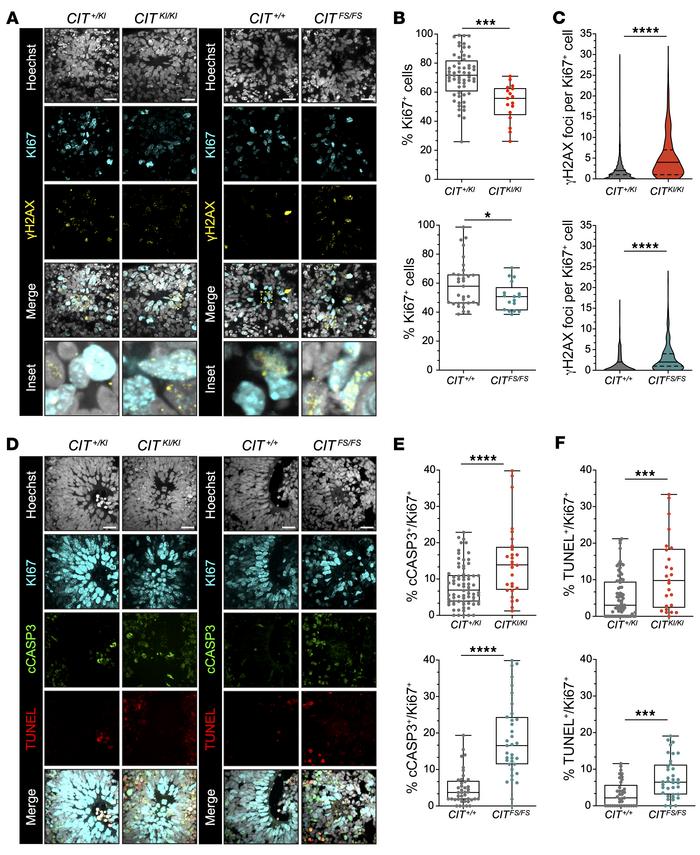 
CIT-affected organoids show accumulation of DNA damage and apoptosis.
(...