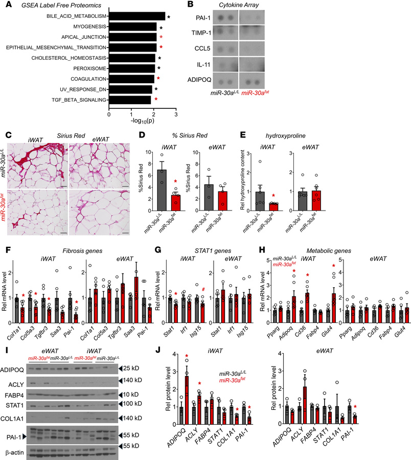 Local antifibrotic effects associated with enforced miR-30a expression i...