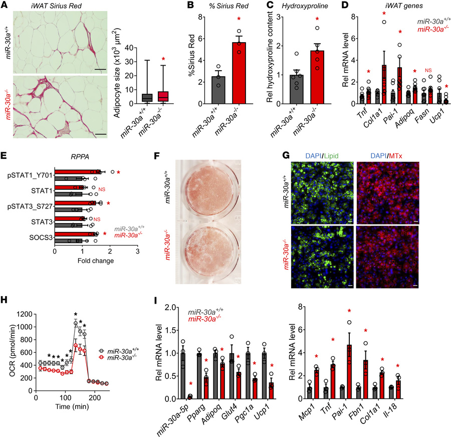 Knockout of miR-30a de-represses fibrosis genes and blocks adipocyte dif...