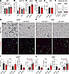 miR-30a expression expands iWAT during HFD feeding.