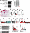 Local antifibrotic effects associated with enforced miR-30a expression in s