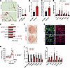 Knockout of miR-30a de-represses fibrosis genes and blocks adipocyte differ