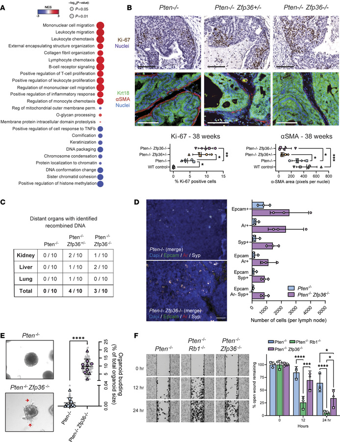 Increased metastatic potential occurs with Zfp36 loss in Pten-null murin...