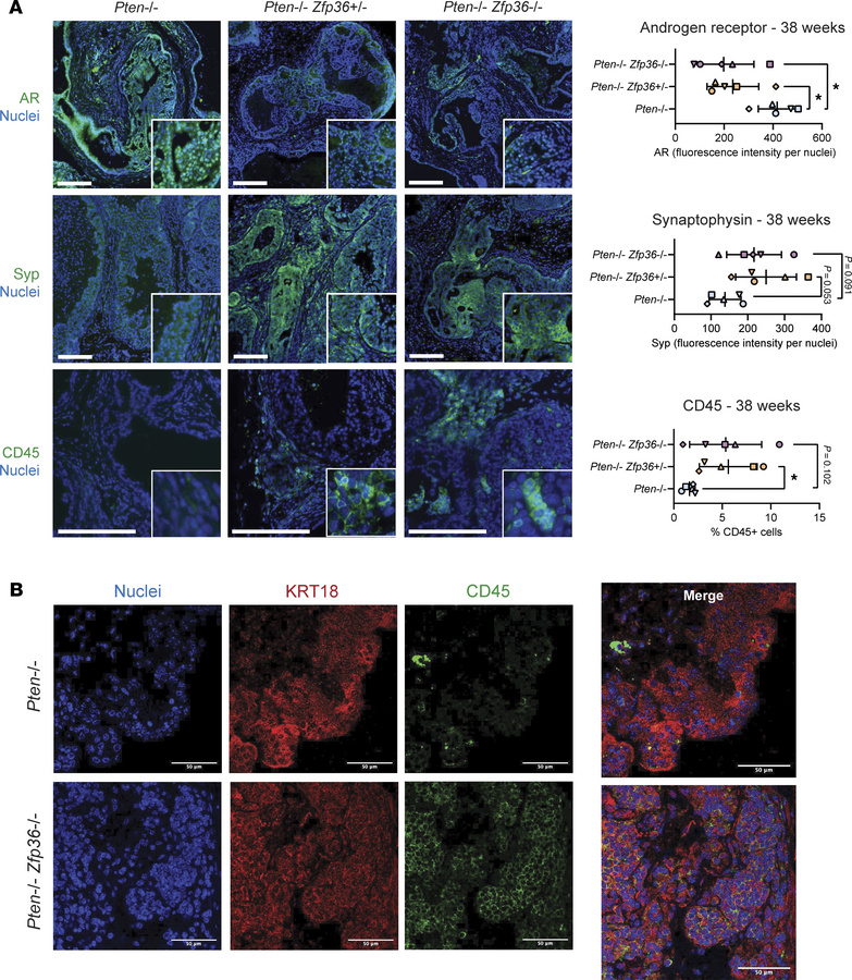 Loss of Zfp36 induces phenotypic plasticity in Pten-null murine prostate...