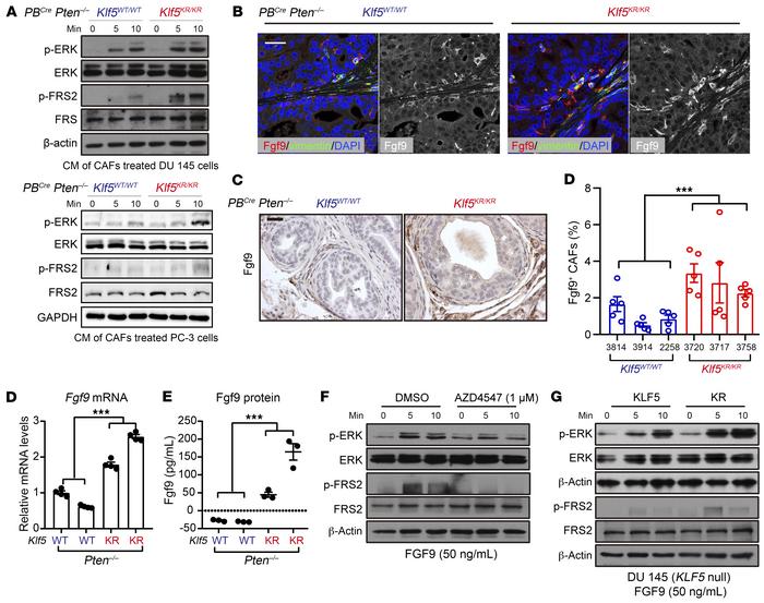 Increased Fgf9 in CAFs contributes to hyperactivated FGFR1 signaling in ...