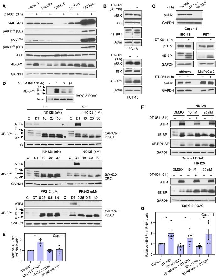 Inhibition of AKT/mTOR signaling does not account for effects of SMAP/B5...
