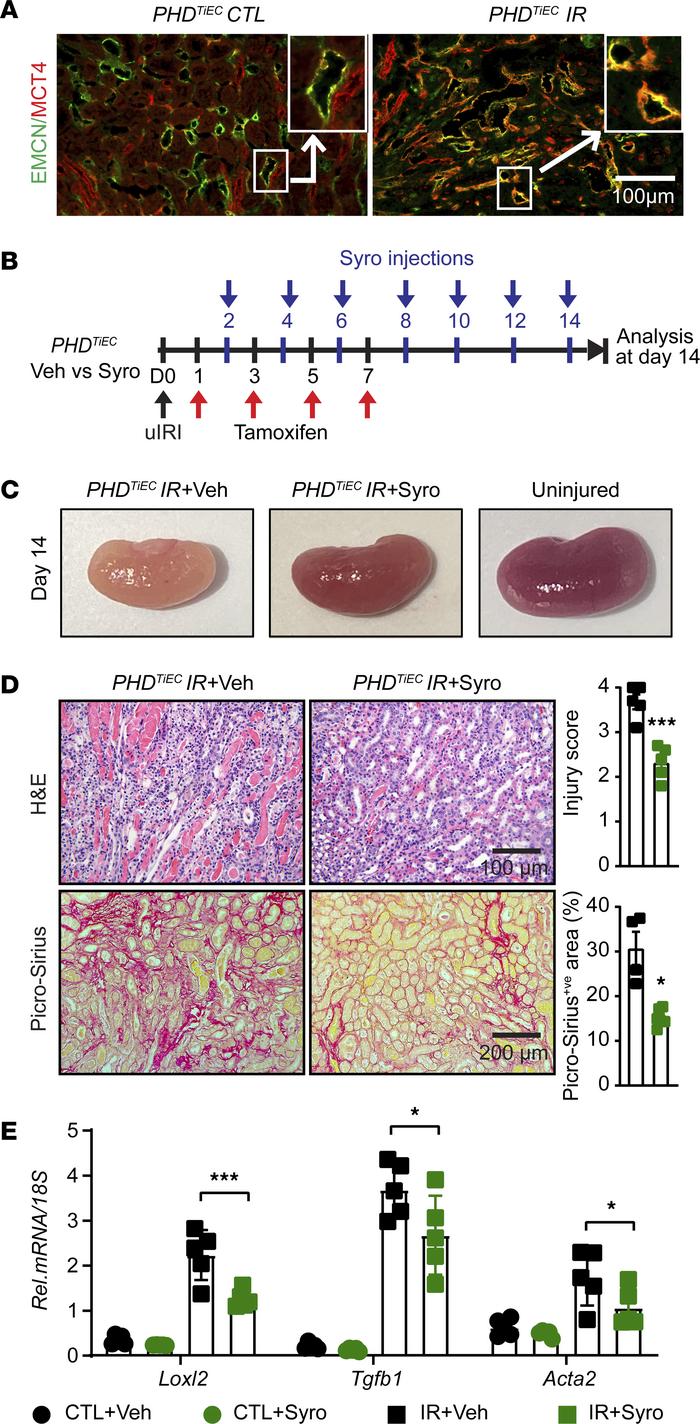 Post-IRI treatment with the MCT4 inhibitor syrosingopine restores adapti...
