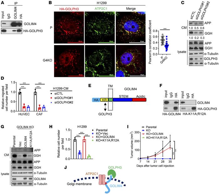 GOLPH3 is a GOLIM4 client protein that promotes secretion.
(A) IP/WB ana...