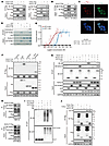 KLHL37 competes with the E3 enzyme to bind N-Myc and prevents its degradati