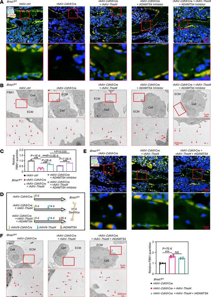 An imbalance in THSD4/ADAMTS4 signaling results in the degradation of th...