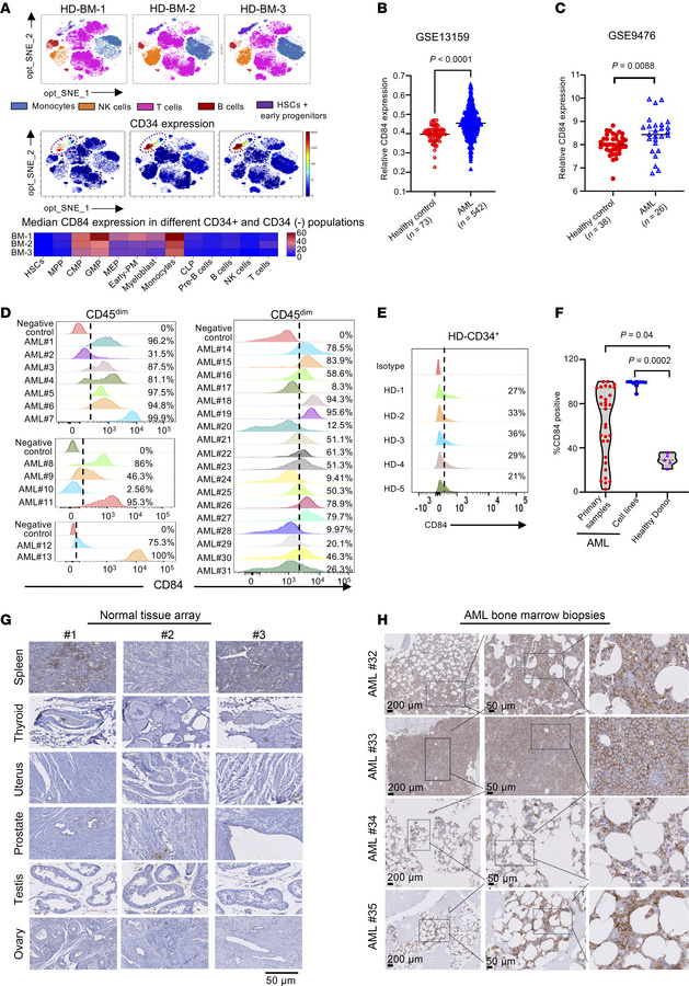 CD84 is overexpressed in AML.
(A) BM cells were subjected to CyTOF immun...