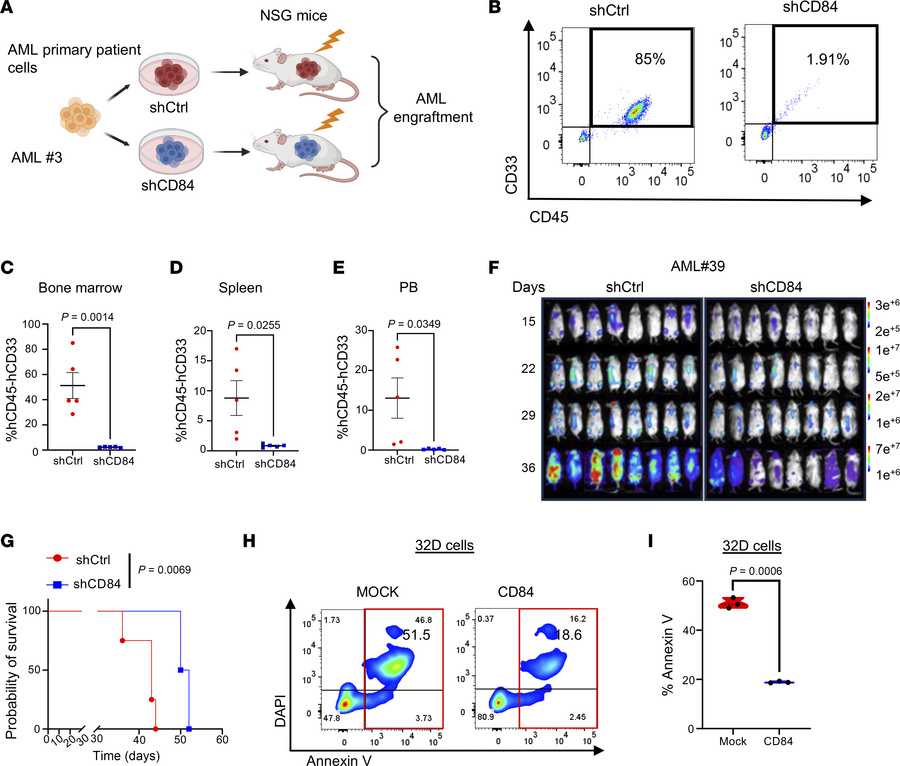 CD84 loss impairs AML development in PDX.
(A) Schematic of the design an...