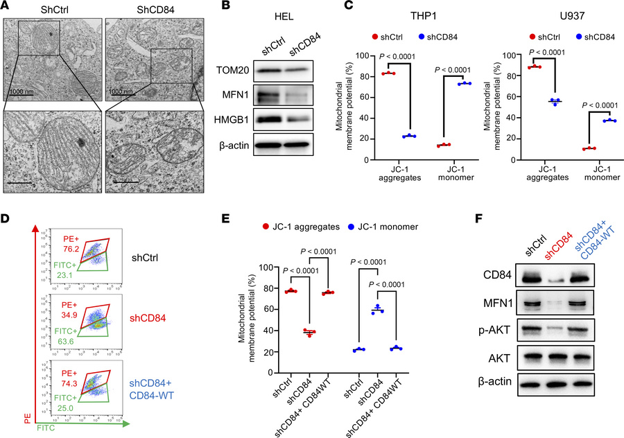 Knockdown of CD84 triggers mitochondrial stress in AML cells.
(A) Repres...