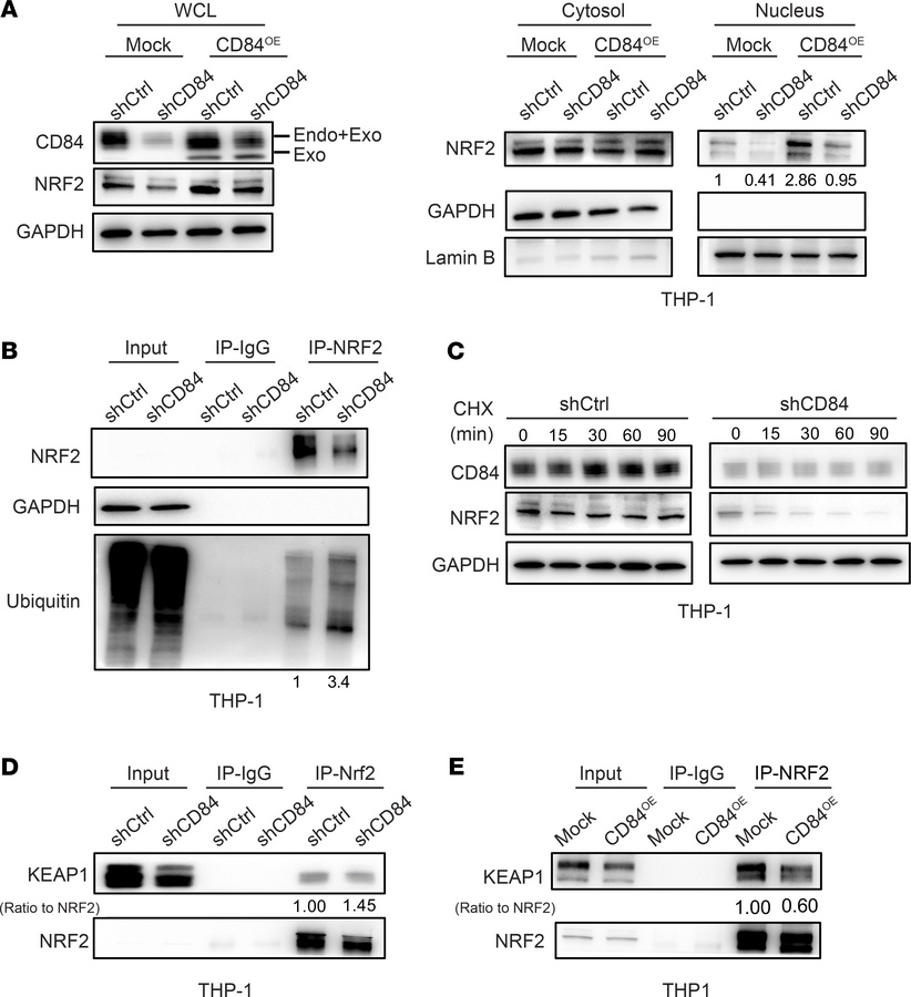 CD84 knockdown disrupts NRF2 binding to Keap1 in AML cells.
(A) The immu...