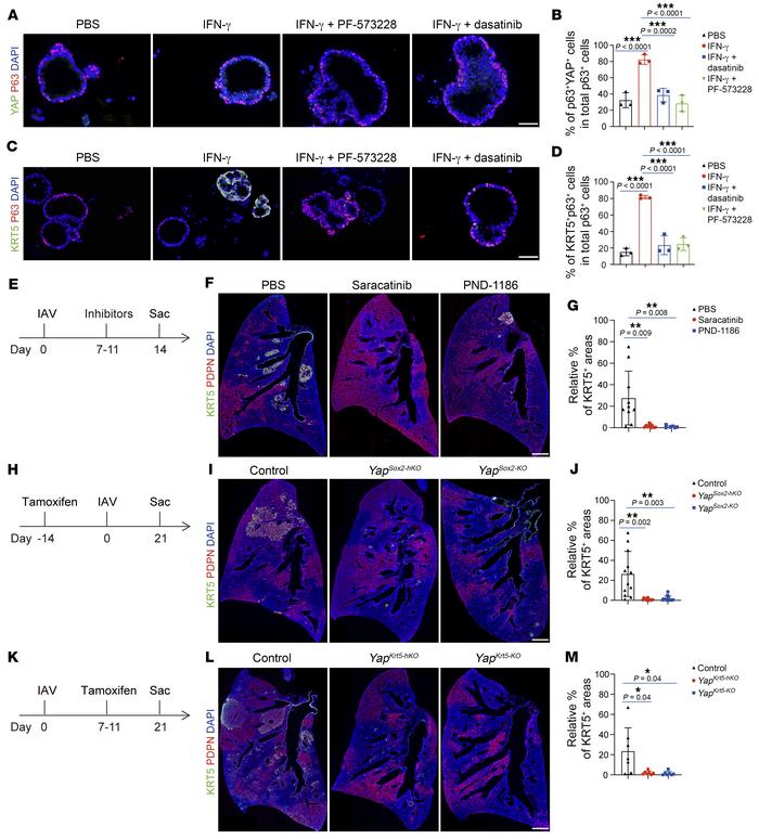 IFN-γ acts through the FAK/Src-YAP signaling axis to promote dysplastic ...