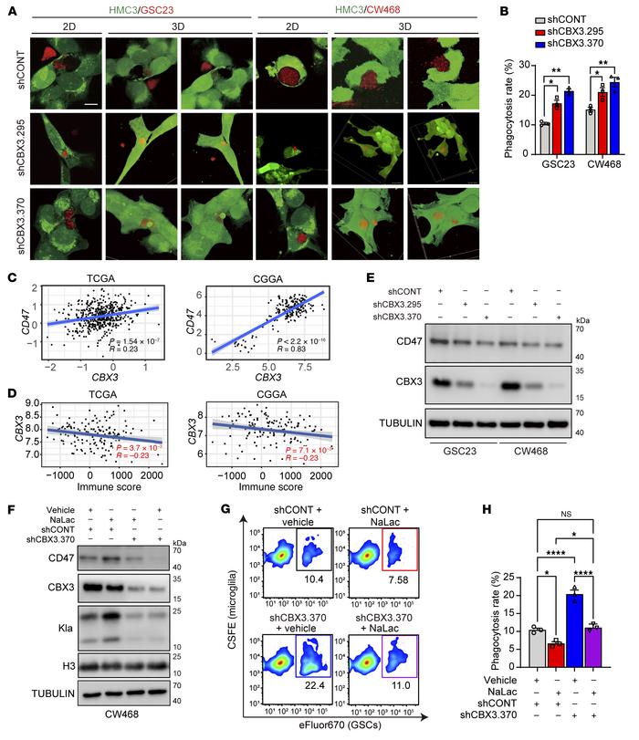 CBX3 knockdown in GBM cells regulates their phagocytosis by microglia.
(...