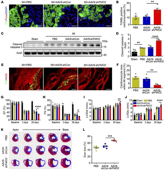 CM-specific FMO2 knockdown impairs cardiac function accompanied by incre...