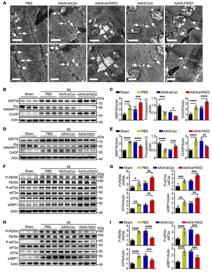 FMO2 exhibits cardiac-protective effects against apoptosis through the U...