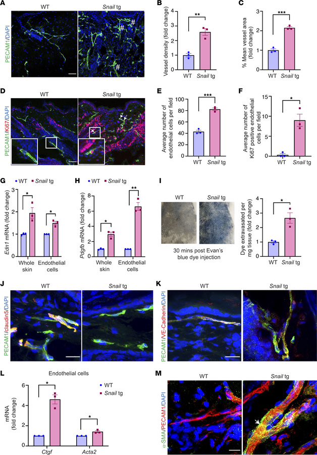 Adult Snail-tg skin recapitulates vasculature abnormalities observed in ...