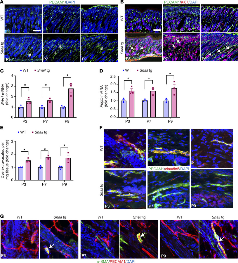 Vasculopathy phenotype occurs early in fibrogenesis.
The skin from P3, P...
