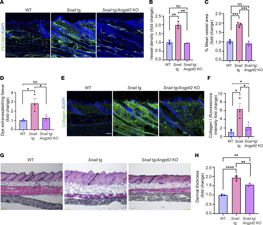 ANGPTL2 is required for development of vasculopathy and fibrosis in Snai...