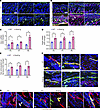 Vasculopathy phenotype occurs early in fibrogenesis.