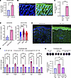 ANGPTL2 is necessary for fibrotic vasculopathy.