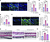 ANGPTL2 is required for development of vasculopathy and fibrosis in Snail-t