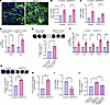 ANGPTL2 is sufficient to drive vasculopathy.