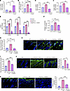 UAS03 abrogates effects of ANGPTL2 on endothelial cells and counteracts fib