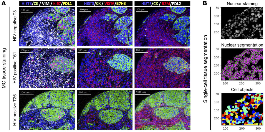 IMC staining and segmentation.
(A) Representative multicolor microphotog...