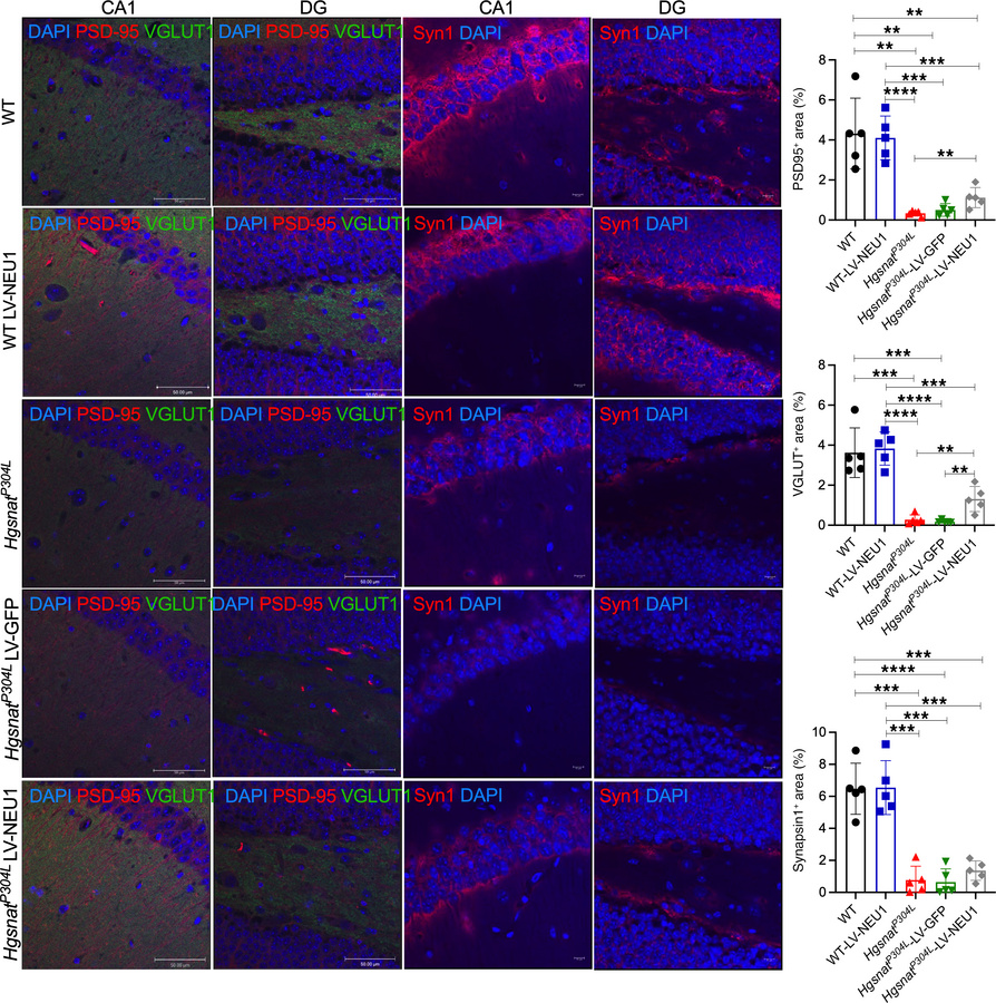 Levels of protein markers of glutamatergic synapse are increased in the ...