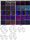 Reduced levels of NEU1 protein in the MPS IIIC mouse brain coincide with ly