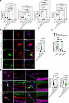 Overexpression of NEU1 and CTSA rescues deficient NEU1, GLB1, and GALNS act