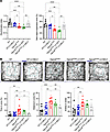HgsnatP304L mice treated with LV-CTSA-IRES-NEU1-GFP show a partial rescue o