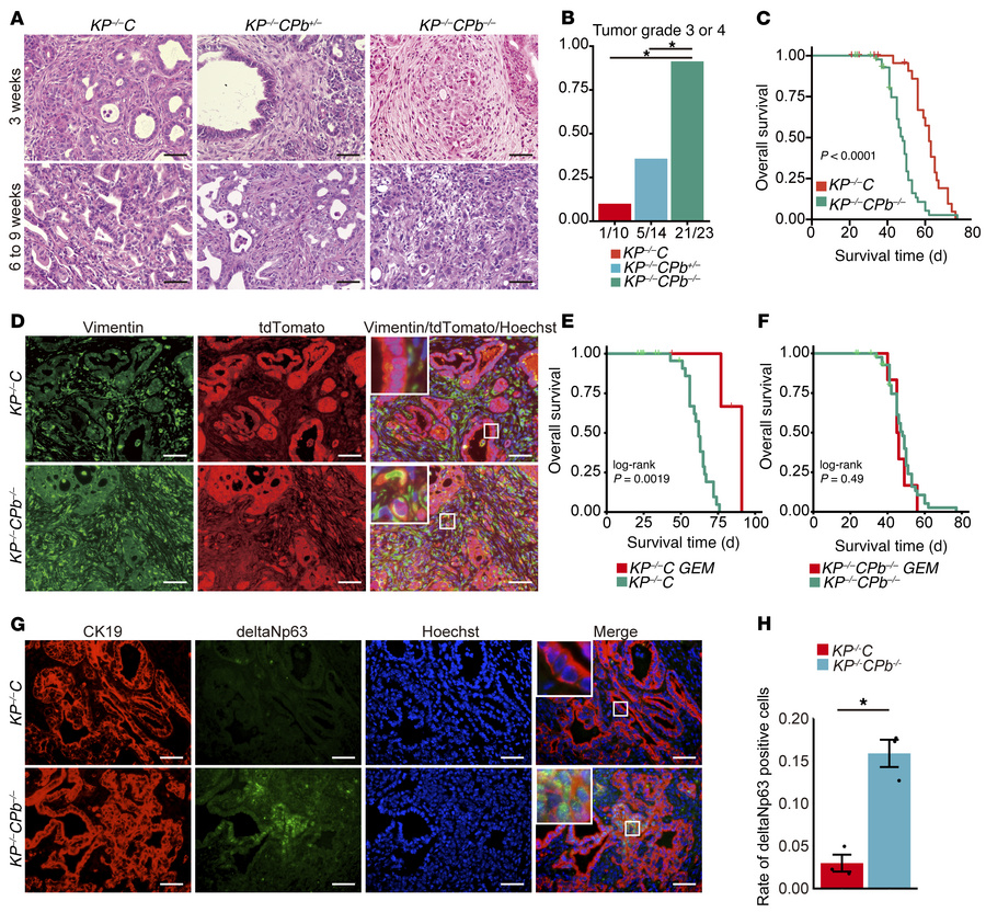 Pancreatic PBRM1 loss synergizes with oncogenic KRAS and homozygous Trp5...