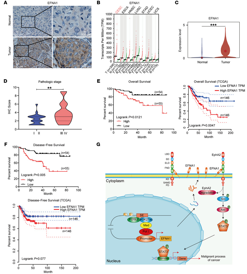 Elevated EFNA1 expression correlates with poor prognosis in CC patients....