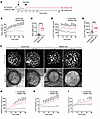 WD leads to body weight gain, glucose intolerance, islet hyperplasia, and i