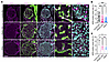 VEGF-A–induced ERK1/2 activation is blunted in pancreatic islet endothelial