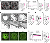 WD undermines VEGF-A regulation of islet hemodynamics and islet vascular ba