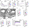 VEGF-A desensitization and ultrastructure-related barrier function impairme