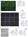 Components of WD increase endothelial cell aPKC activity and undermine VEGF