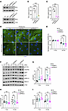 aPKC knockdown restores VEGF-A–induced VEGFR2 internalization and AKT phosp