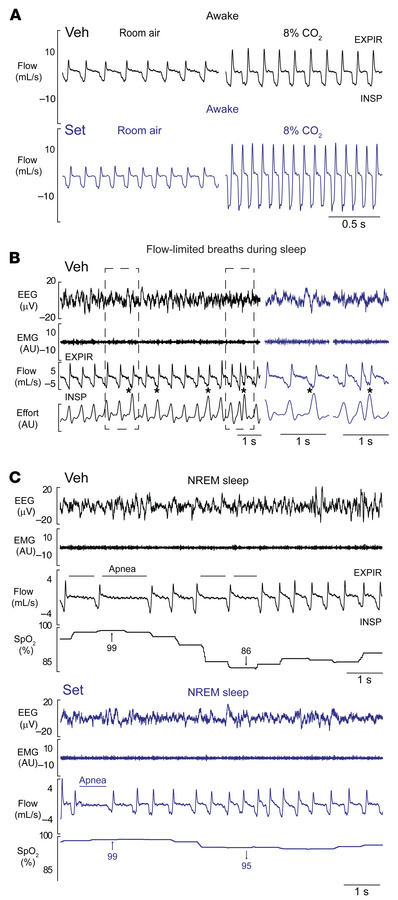 Representative respiratory recordings in DIO male mice treated with a si...