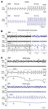 Representative respiratory recordings in DIO male mice treated with a singl