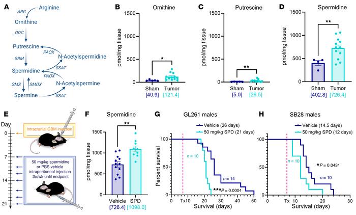 SPD levels are increased in mouse GBM models and drive GBM progression.
...