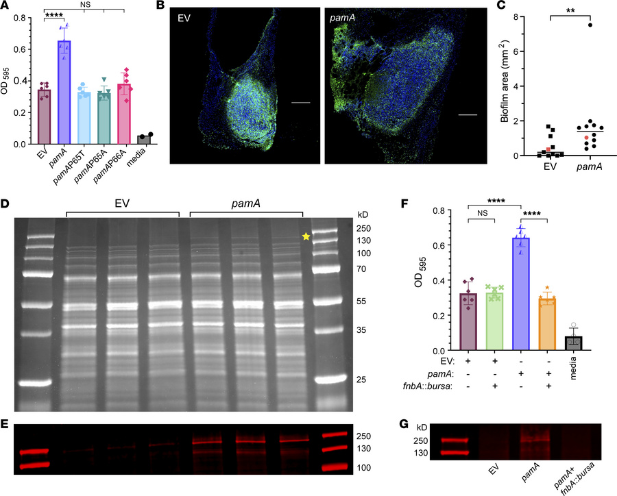 
pamA methylase increases biofilm production through fnbA (FnBPA).
(A) E...