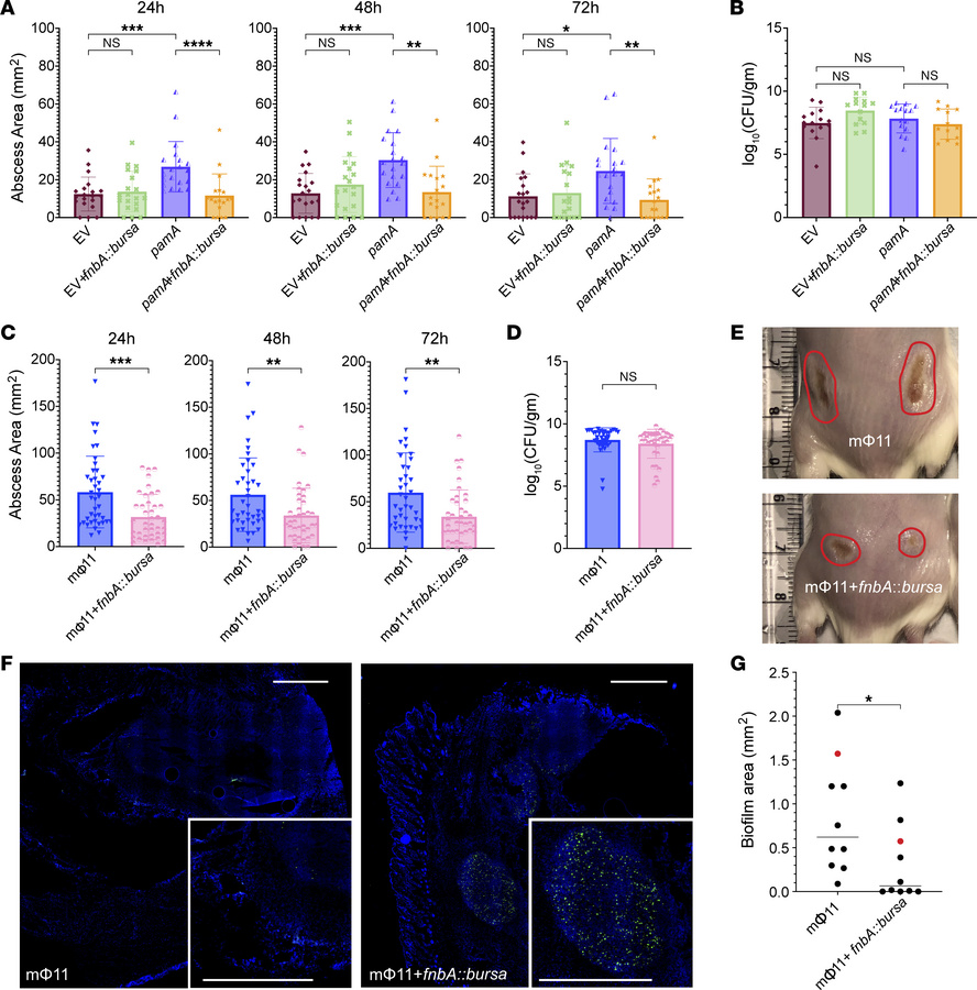 
fnbA deficiency decreases pamA-mediated skin abscess size and biofilm p...