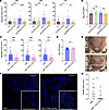 fnbA deficiency decreases pamA-mediated skin abscess size and biofilm produ