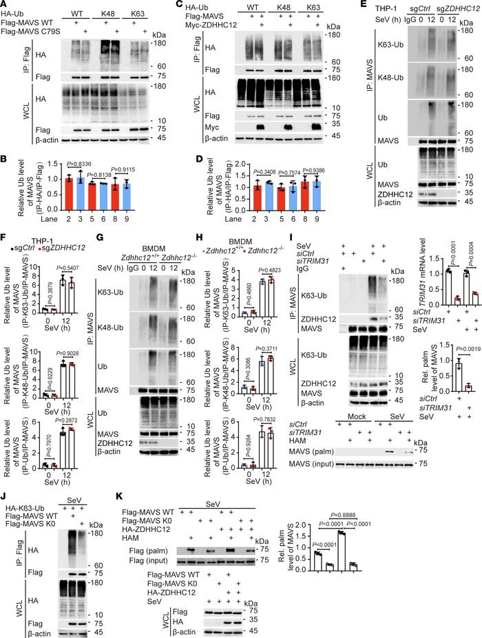K63 ubiquitination of MAVS facilitates its palmitoylation.
(A and B) HEK...